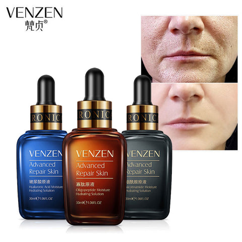 Venzen Advanced Repair Skin 30ml