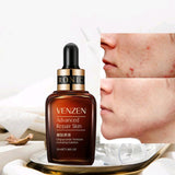 Venzen Advanced Repair Skin 30ml