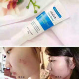Yanhee Acne Cream 10 g